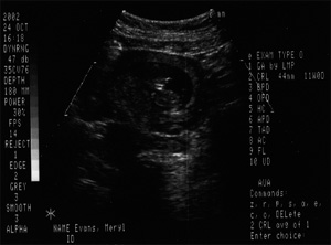 Sonogram shot numero dos. Click for larger detail.