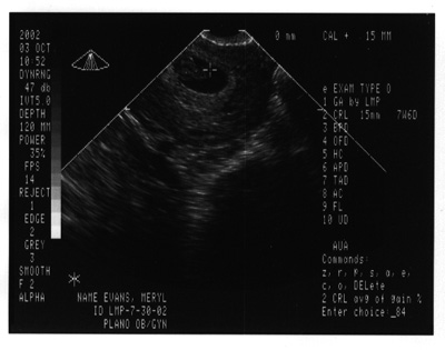 The first sonogram taken on October 3, 2002